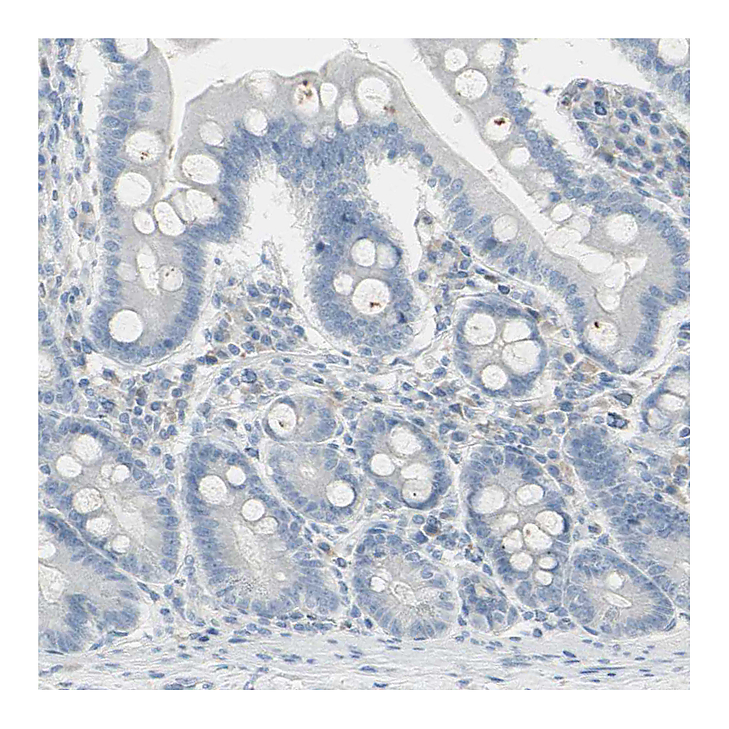 Atlas Antibodies Anti-PIP Antibody