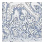 Atlas Antibodies Anti-PIP Antibody