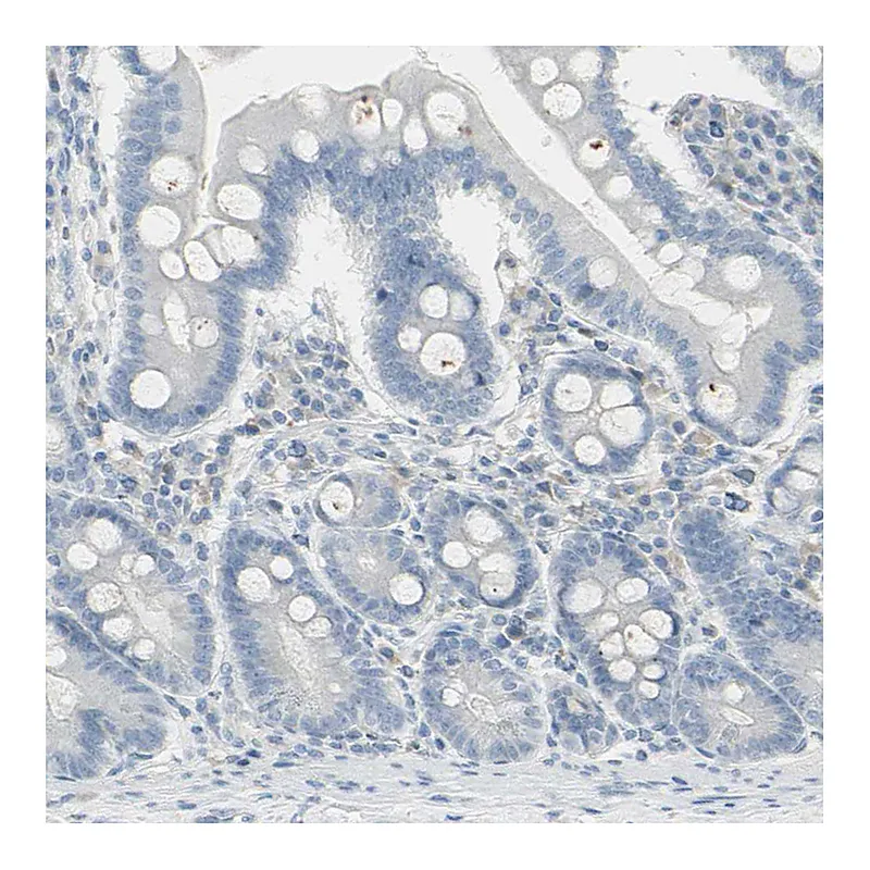 Atlas Antibodies Anti-PIP Antibody