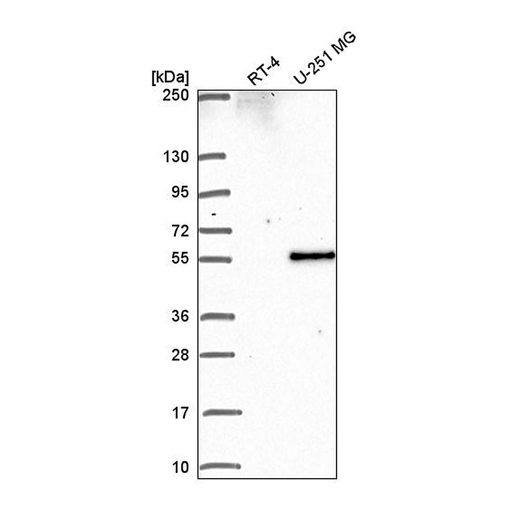 Atlas Antibodies Anti-PIP4K2B Antibody
