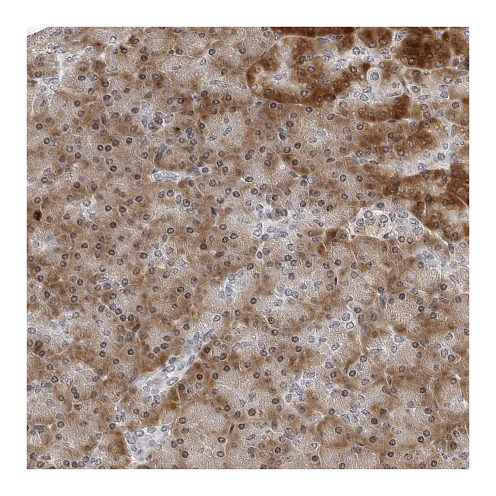 Atlas Antibodies Anti-PIP4K2C Antibody