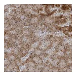 Atlas Antibodies Anti-PIP4K2C Antibody