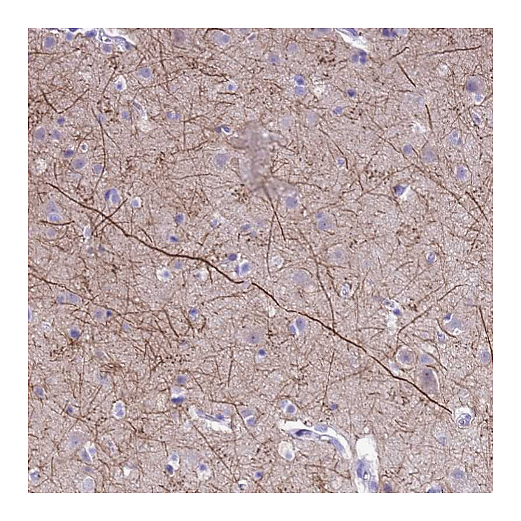 Atlas Antibodies Anti-PIP4K2B Antibody