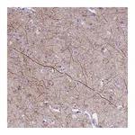 Atlas Antibodies Anti-PIP4K2B Antibody