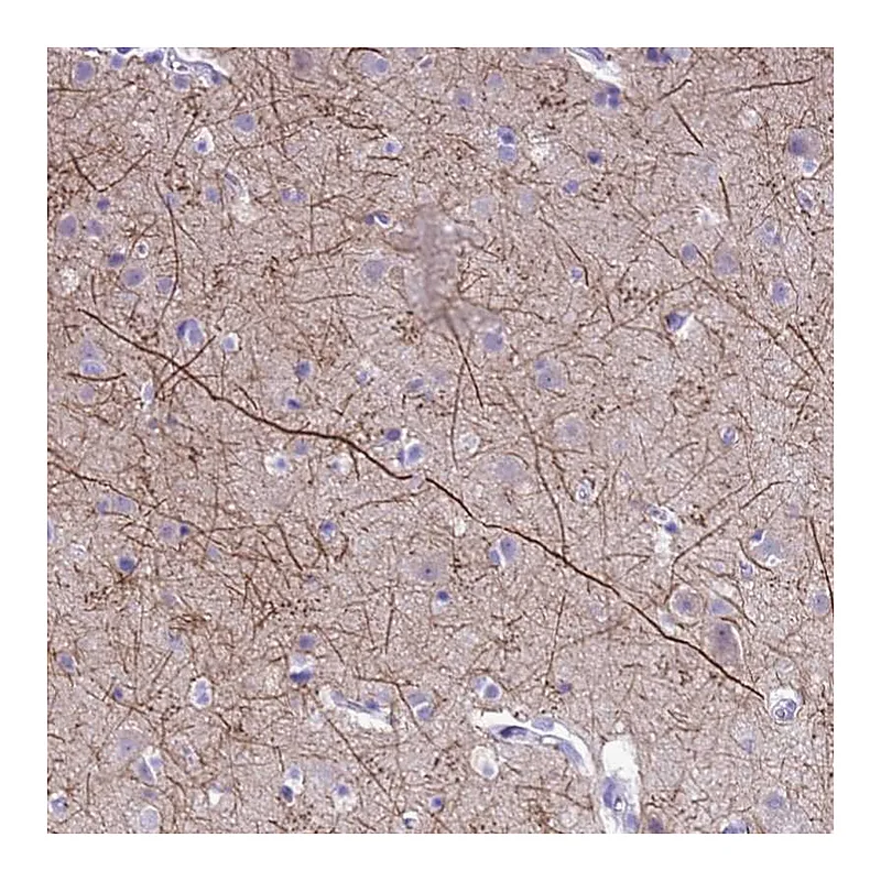 Atlas Antibodies Anti-PIP4K2B Antibody
