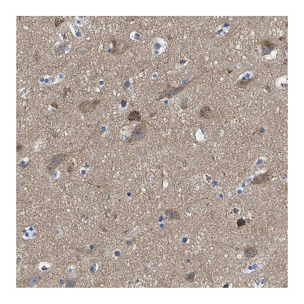 Atlas Antibodies Anti-PIP5K1C Antibody