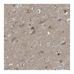Atlas Antibodies Anti-PIP5K1C Antibody