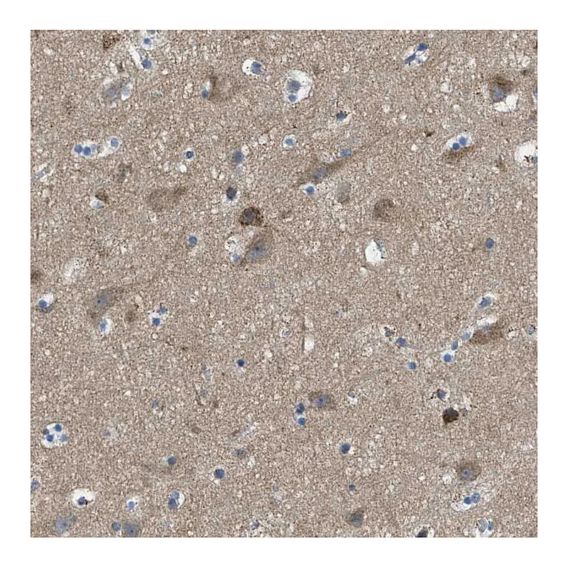 Atlas Antibodies Anti-PIP5K1C Antibody