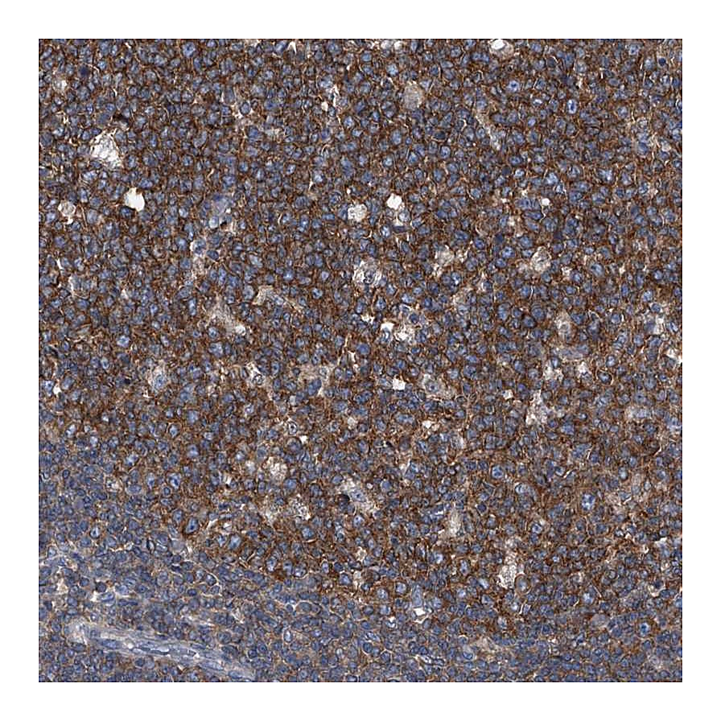 Atlas Antibodies Anti-PIP5K1A Antibody