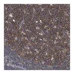 Atlas Antibodies Anti-PIP5K1A Antibody