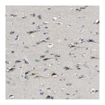 Atlas Antibodies Anti-PIP5K1B Antibody