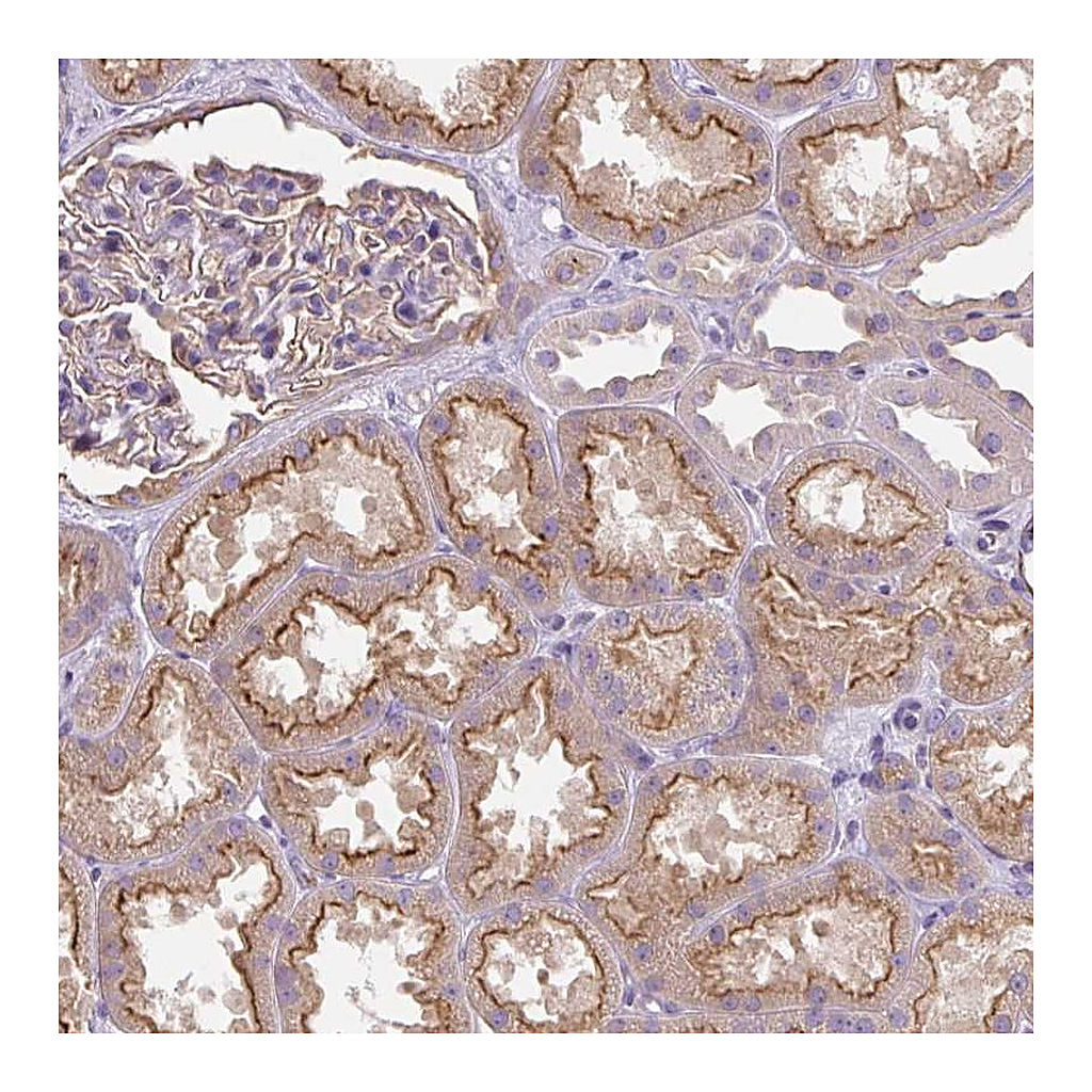 Atlas Antibodies Anti-PIP5KL1 Antibody