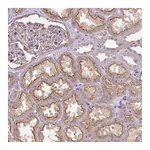 Atlas Antibodies Anti-PIP5KL1 Antibody