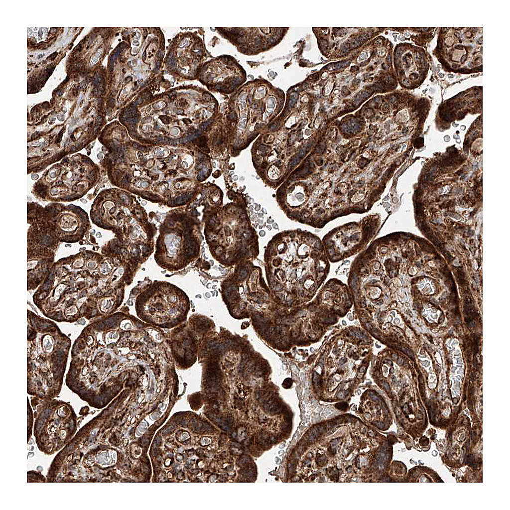 Atlas Antibodies Anti-PISD Antibody
