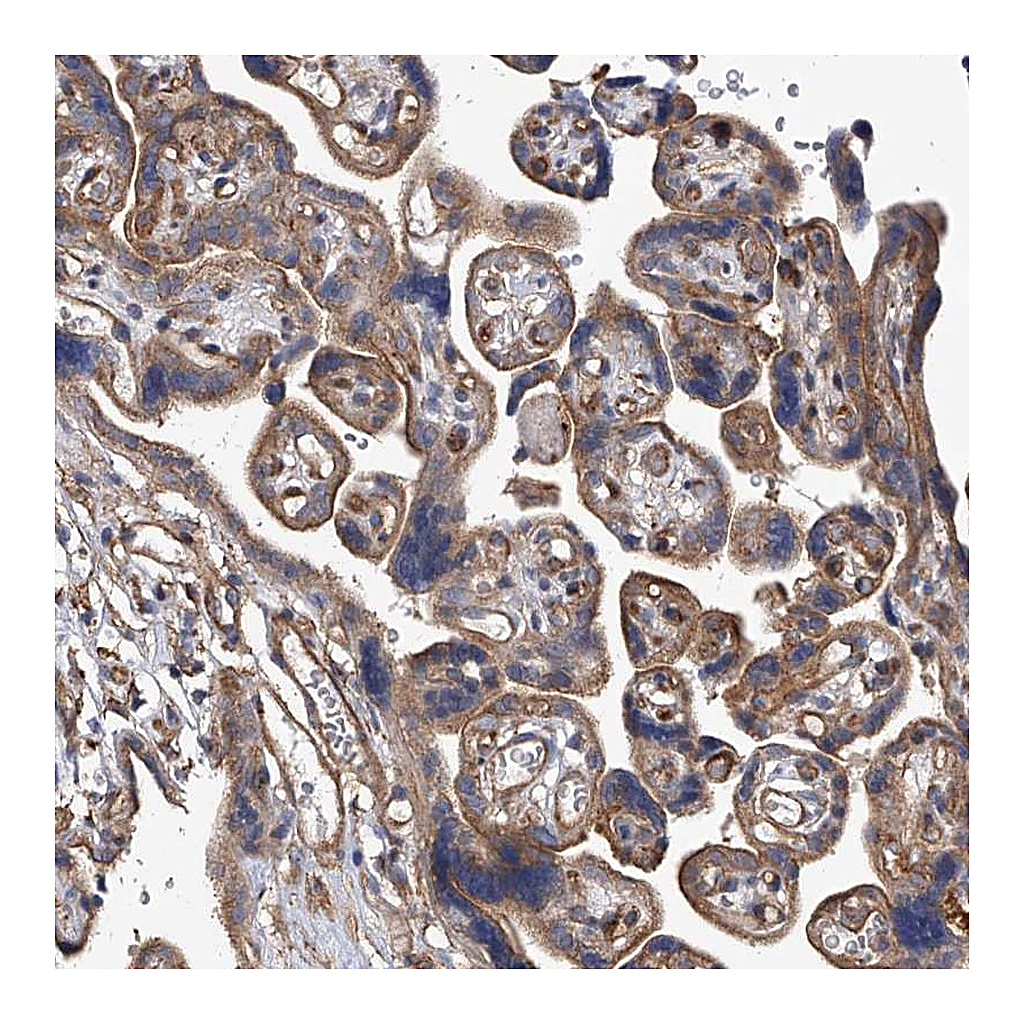 Atlas Antibodies Anti-PISD Antibody