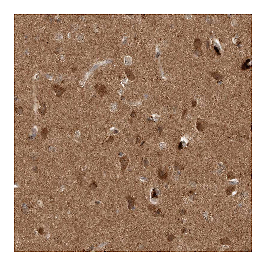 Atlas Antibodies Anti-PITPNC1 Antibody