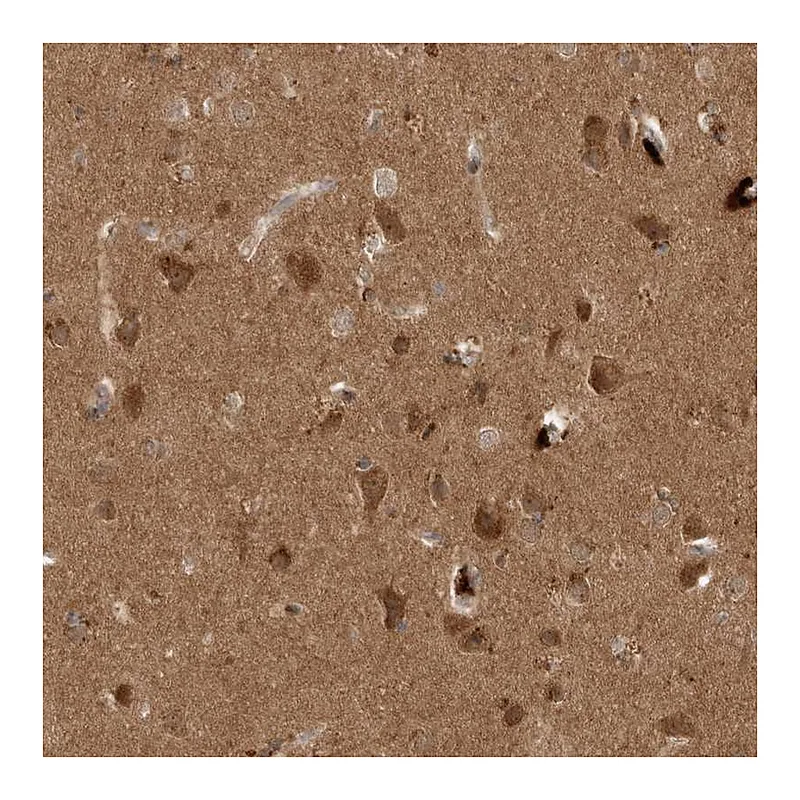 Atlas Antibodies Anti-PITPNC1 Antibody