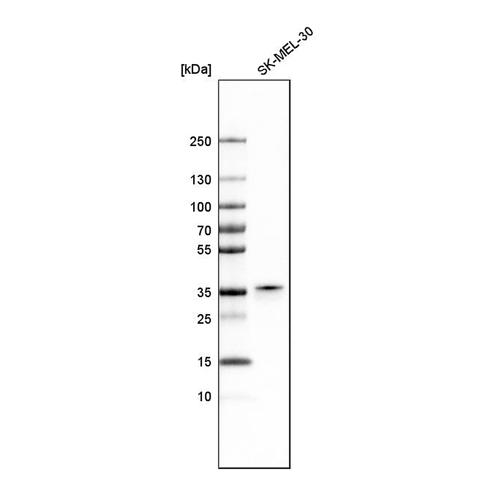 Atlas Antibodies Anti-PIR Antibody
