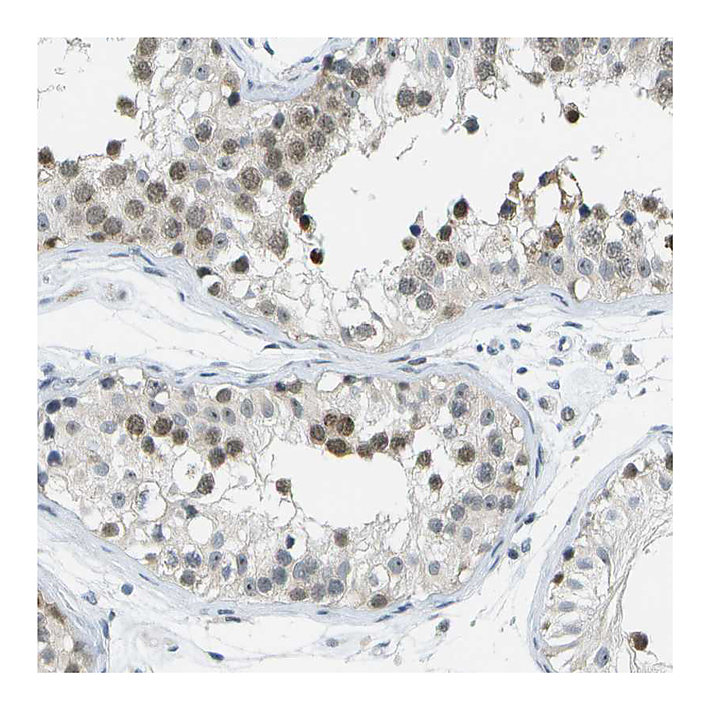 Atlas Antibodies Anti-PITHD1 Antibody