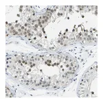 Atlas Antibodies Anti-PITHD1 Antibody