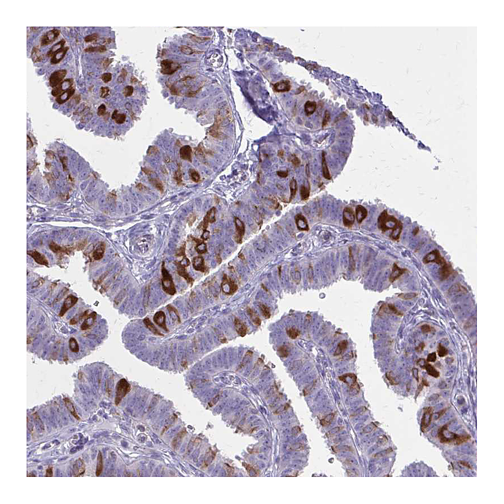 Atlas Antibodies Anti-PITPNM1 Antibody
