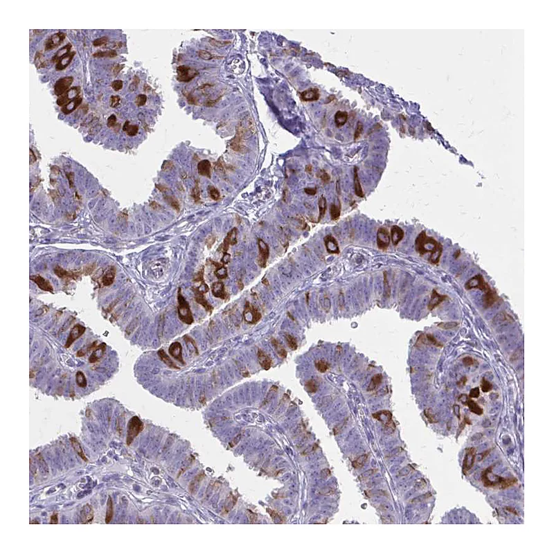 Atlas Antibodies Anti-PITPNM1 Antibody