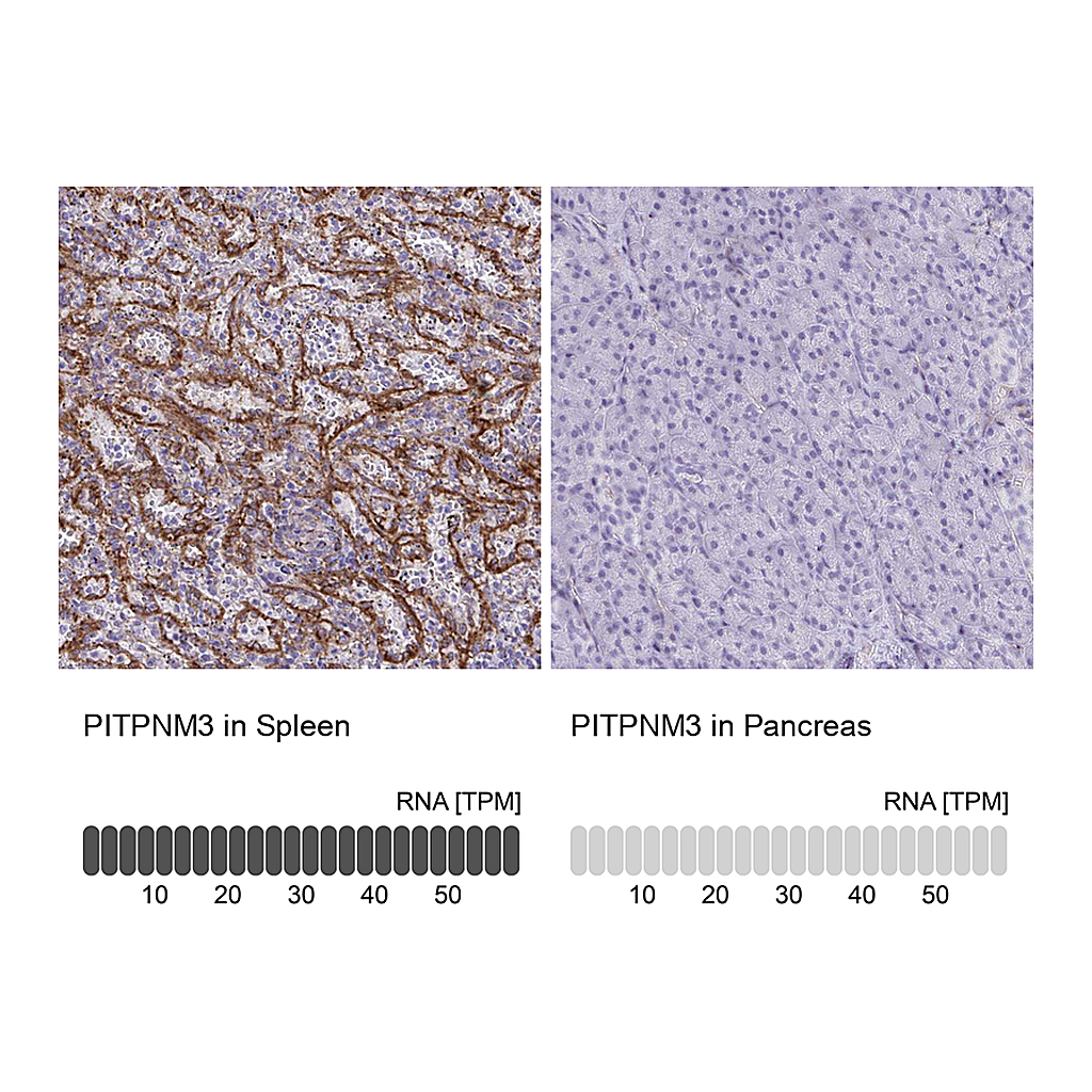 Atlas Antibodies Anti-PITPNM3 Antibody