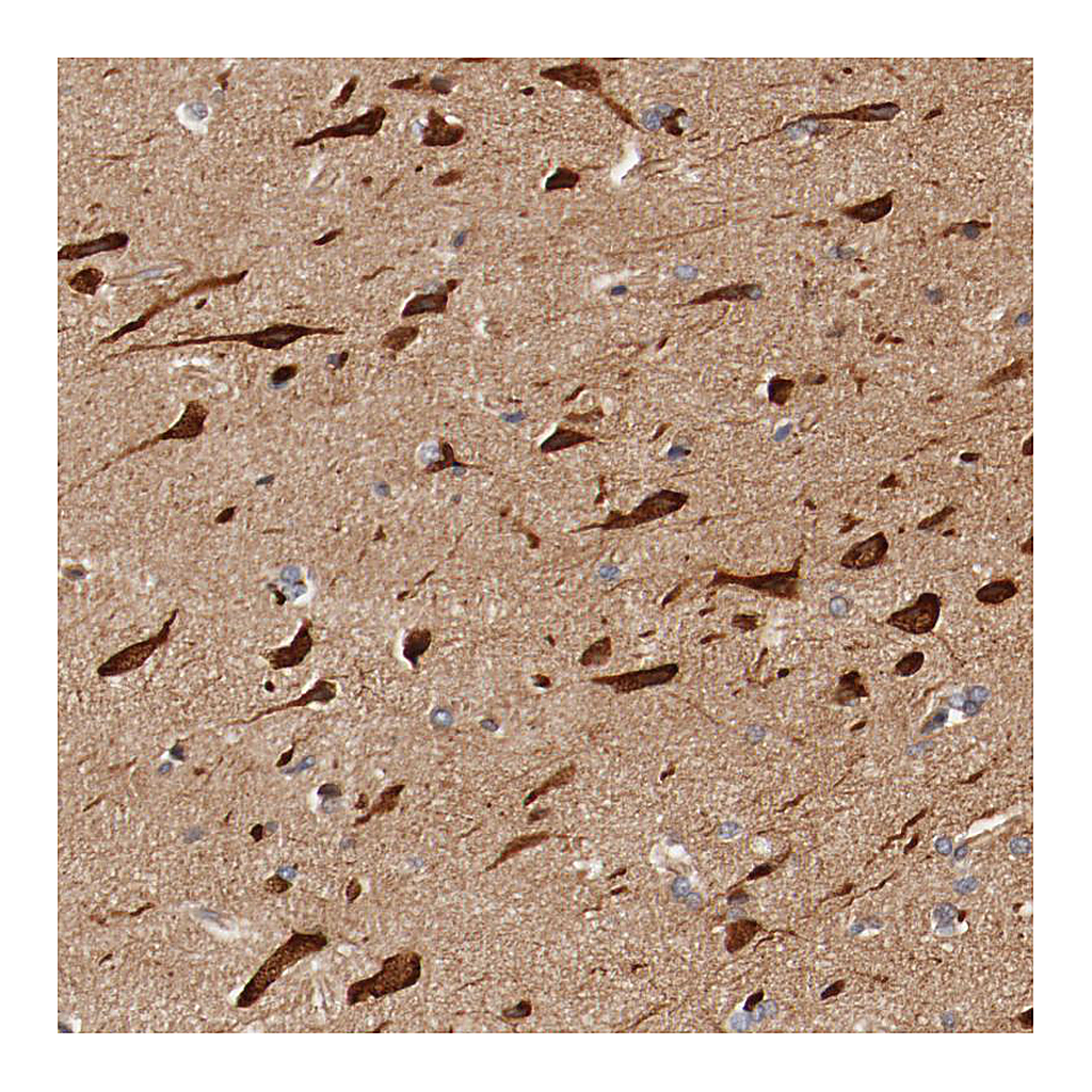 Atlas Antibodies Anti-PITPNM2 Antibody