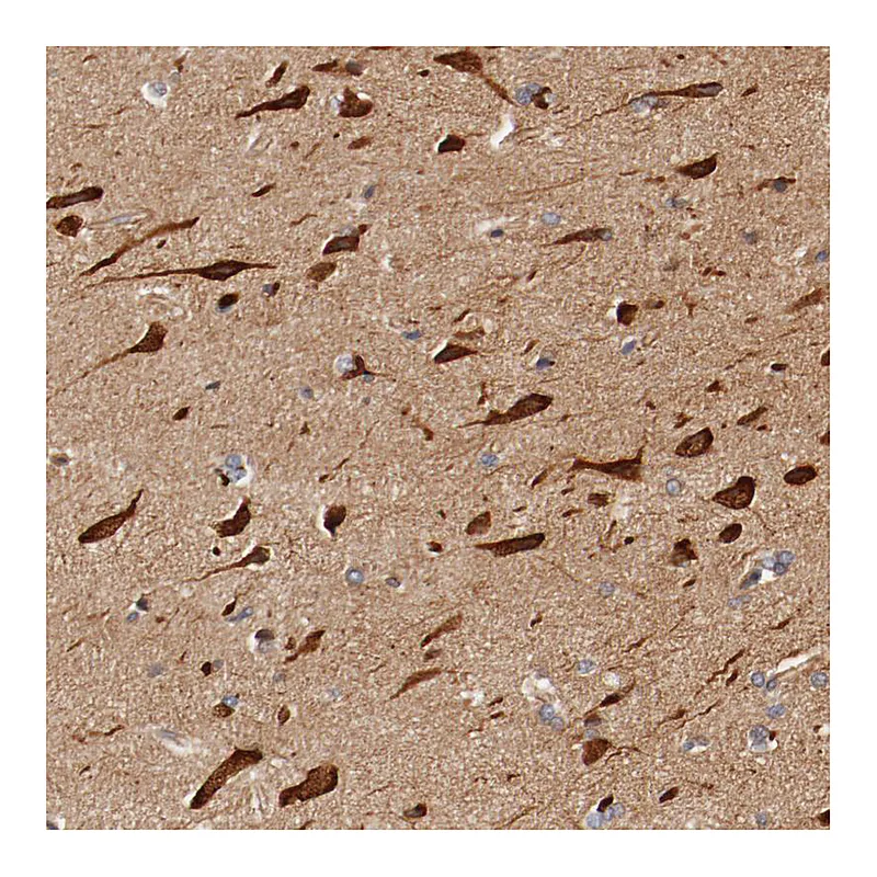 Atlas Antibodies Anti-PITPNM2 Antibody
