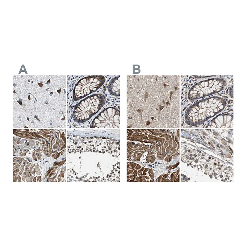 Atlas Antibodies Anti-PITRM1 Antibody