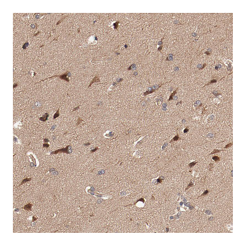 Atlas Antibodies Anti-PITPNM2 Antibody
