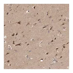 Atlas Antibodies Anti-PITPNM2 Antibody