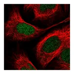 Atlas Antibodies Anti-PITX2 Antibody