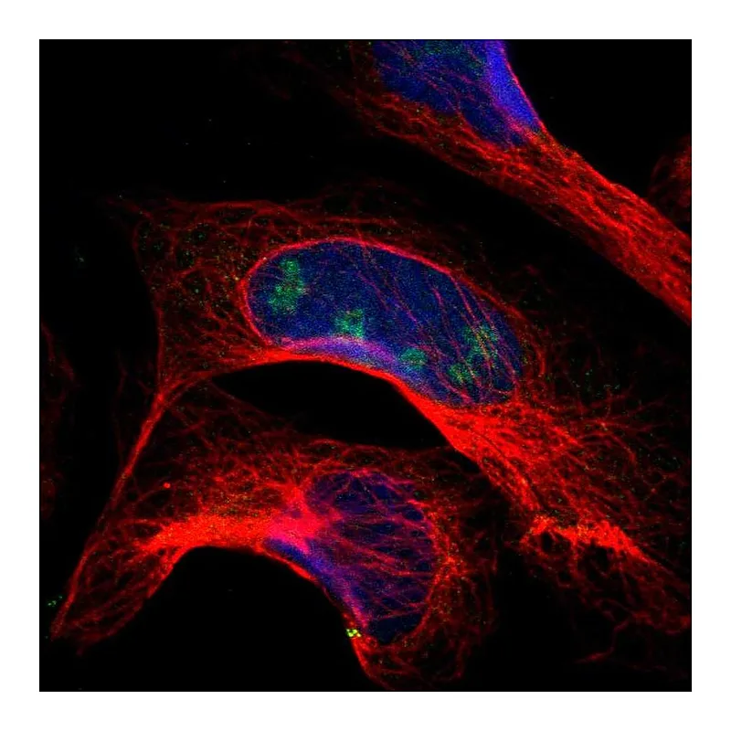 Atlas Antibodies Anti-PITX1 Antibody