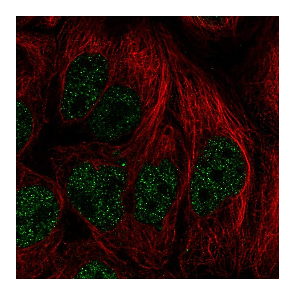 Atlas Antibodies Anti-PITX2 Antibody