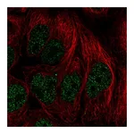 Atlas Antibodies Anti-PITX2 Antibody