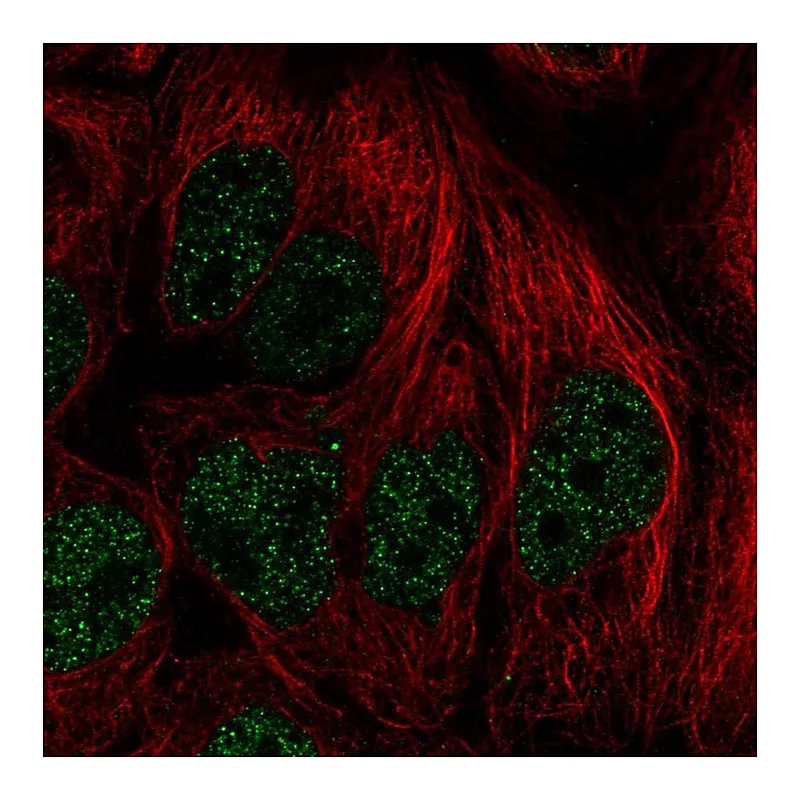 Atlas Antibodies Anti-PITX2 Antibody