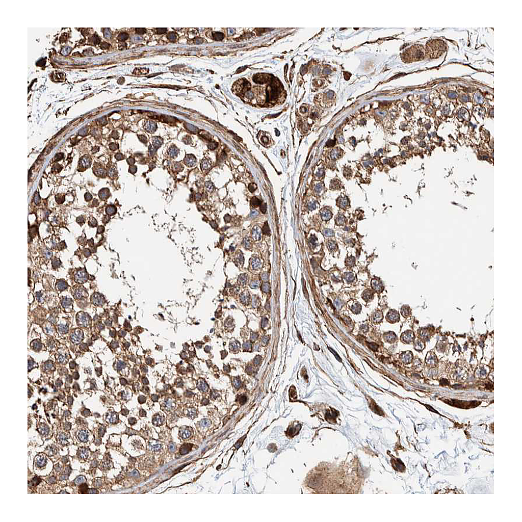 Atlas Antibodies Anti-PKD1L1 Antibody