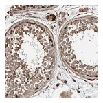 Atlas Antibodies Anti-PKD1L1 Antibody