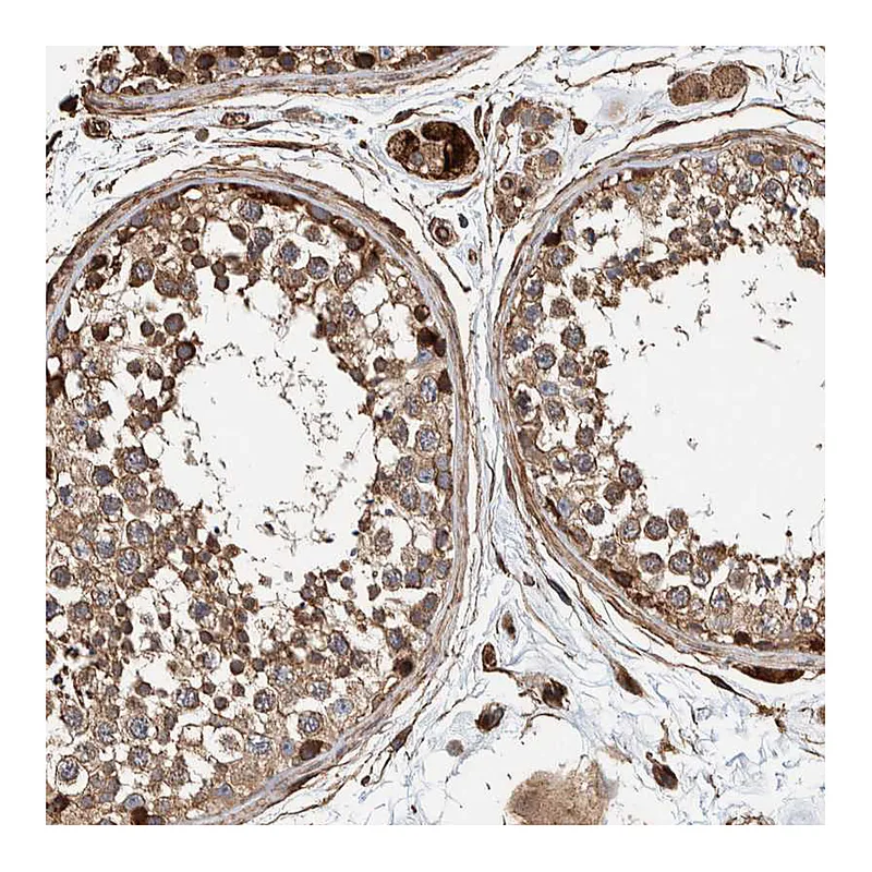 Atlas Antibodies Anti-PKD1L1 Antibody