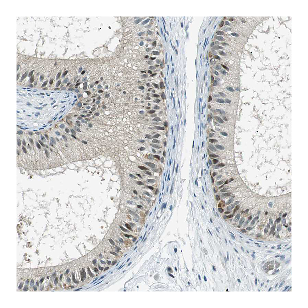 Atlas Antibodies Anti-PJA1 Antibody