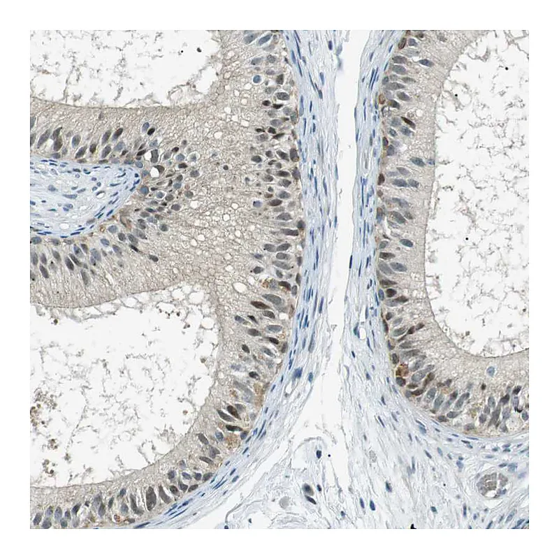 Atlas Antibodies Anti-PJA1 Antibody