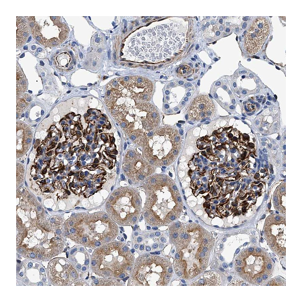 Atlas Antibodies Anti-PKD1L1 Antibody