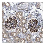 Atlas Antibodies Anti-PKD1L1 Antibody