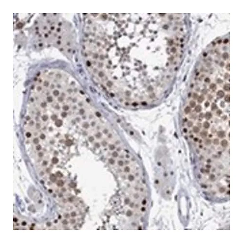 Merck Anti-RAD54L2 antibody produced in rabbit