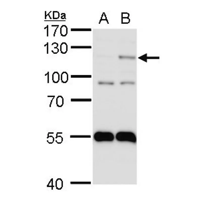 Merck ANTI-EPAS1