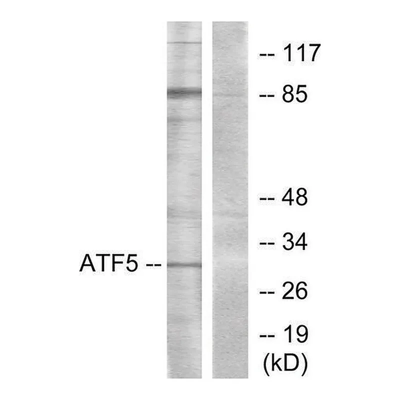 Merck Anti-ATF5 antibody produced in rabbit