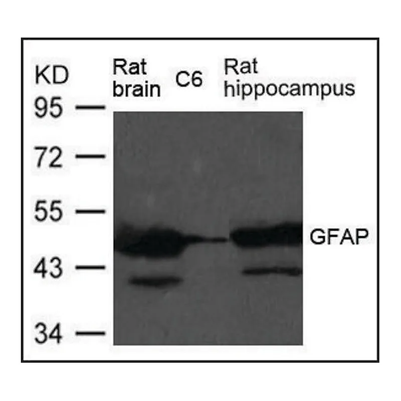 Merck Anti-GFAP antibody produced in rabbit