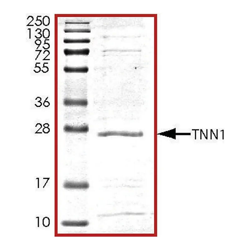 Merck Troponin1, His tagged human
