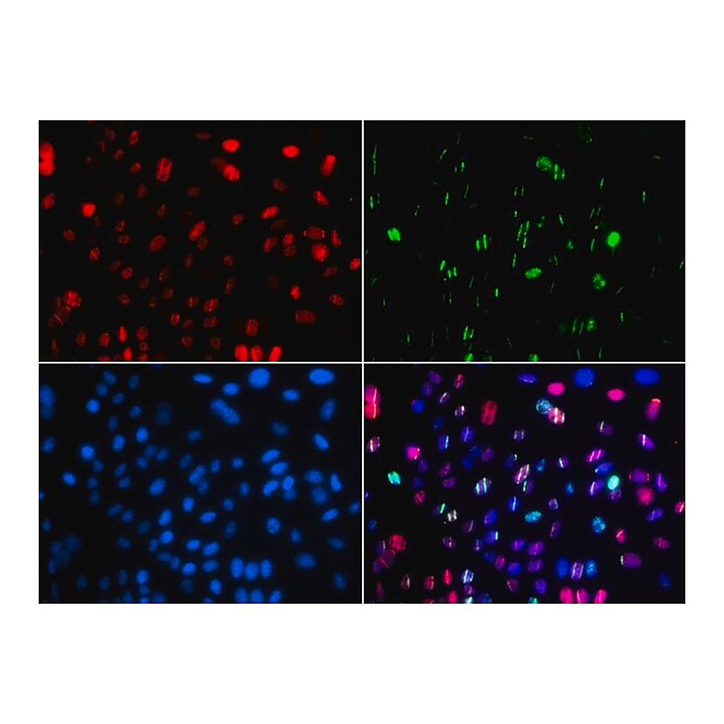Merck Anti-Phospho-p53-S15 antibody produced in rabbit